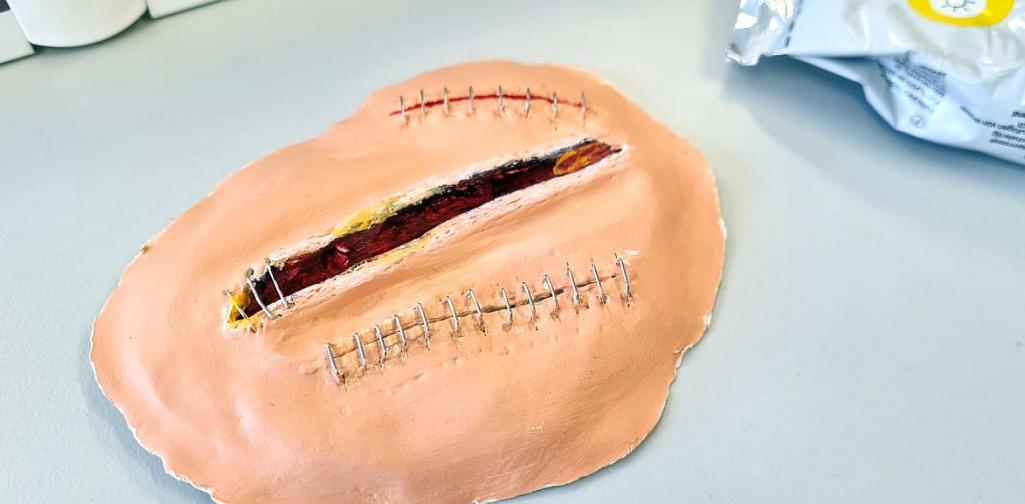 Bild zeigt ein Tonmodell von drei Schnittwunden zwei sind schon geklammert die dritte ist noch offen.